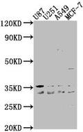 Western Blot
Positive WB detected in: U87 whole cell lysate, U251 whole cell lysate, A549 whole cell lysate, MCF-7 whole cell lysate
All lanes: ATP6V1D antibody at 1:2000
Secondary
Goat polyclonal to rabbit IgG at 1/50000 dilution
Predicted band size: 29 kDa
Observed band size: 29 kDa