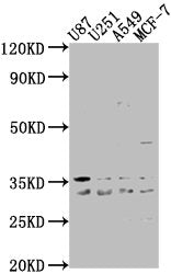 Western Blot
Positive WB detected in: U87 whole cell lysate, U251 whole cell lysate, A549 whole cell lysate, MCF-7 whole cell lysate
All lanes: ATP6V1D antibody at 1:2000
Secondary
Goat polyclonal to rabbit IgG at 1/50000 dilution
Predicted band size: 29 kDa
Observed band size: 29 kDa