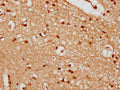 IHC image of CSB-PA897566LA01HU diluted at 1:300 and staining in paraffin-embedded human brain tissue performed on a Leica BondTM system. After dewaxing and hydration, antigen retrieval was mediated by high pressure in a citrate buffer (pH 6.0). Section was blocked with 10% normal goat serum 30min at RT. Then primary antibody (1% BSA) was incubated at 4&deg;C overnight. The primary is detected by a biotinylated secondary antibody and visualized using an HRP conjugated SP system.