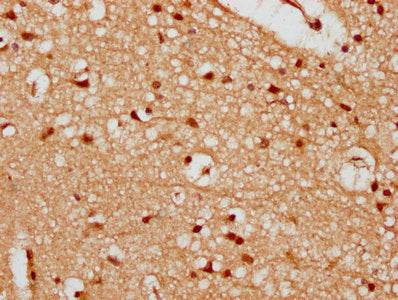 IHC image of CSB-PA897566LA01HU diluted at 1:300 and staining in paraffin-embedded human brain tissue performed on a Leica BondTM system. After dewaxing and hydration, antigen retrieval was mediated by high pressure in a citrate buffer (pH 6.0). Section was blocked with 10% normal goat serum 30min at RT. Then primary antibody (1% BSA) was incubated at 4&deg;C overnight. The primary is detected by a biotinylated secondary antibody and visualized using an HRP conjugated SP system.