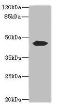 Western blot
All lanes: ACTL7B antibody at 0.2ug/ml + Mouse gonadal tissue
Secondary
Goat polyclonal to rabbit IgG at 1/10000 dilution
Predicted band size: 45 kDa
Observed band size: 45 kDa