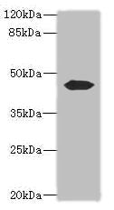 Western blot
All lanes: ACTL7B antibody at 0.2ug/ml + Mouse gonadal tissue
Secondary
Goat polyclonal to rabbit IgG at 1/10000 dilution
Predicted band size: 45 kDa
Observed band size: 45 kDa