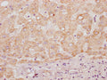 IHC image of CSB-PA897580LA01HU diluted at 1:100 and staining in paraffin-embedded human liver tissue performed on a Leica BondTM system. After dewaxing and hydration, antigen retrieval was mediated by high pressure in a citrate buffer (pH 6.0). Section was blocked with 10% normal goat serum 30min at RT. Then primary antibody (1% BSA) was incubated at 4°C overnight. The primary is detected by a Goat anti-rabbit polymer IgG labeled by HRP and visualized using 0.05% DAB.