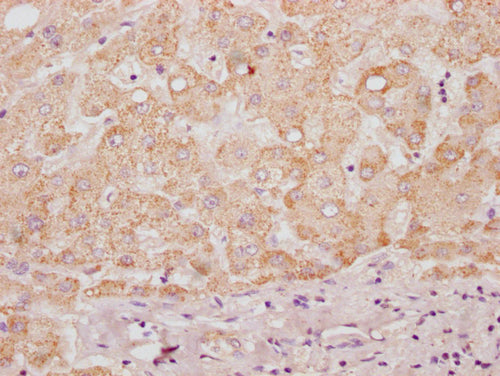IHC image of CSB-PA897580LA01HU diluted at 1:100 and staining in paraffin-embedded human liver tissue performed on a Leica BondTM system. After dewaxing and hydration, antigen retrieval was mediated by high pressure in a citrate buffer (pH 6.0). Section was blocked with 10% normal goat serum 30min at RT. Then primary antibody (1% BSA) was incubated at 4°C overnight. The primary is detected by a Goat anti-rabbit polymer IgG labeled by HRP and visualized using 0.05% DAB.