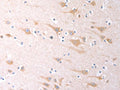 The image on the left is immunohistochemistry of paraffin-embedded Human brain tissue using CSB-PA897666(SCGB1A1 Antibody) at dilution 1/60, on the right is treated with fusion protein. (Original magnification: ×200)