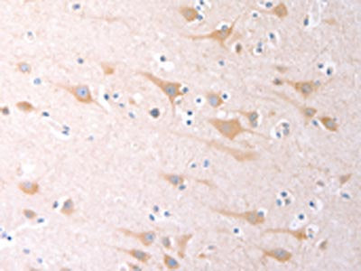The image on the left is immunohistochemistry of paraffin-embedded Human brain tissue using CSB-PA897666(SCGB1A1 Antibody) at dilution 1/60, on the right is treated with fusion protein. (Original magnification: ×200)
