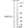 Western blot analysis of extracts from COLO cells, using AKR1C2 antibody.