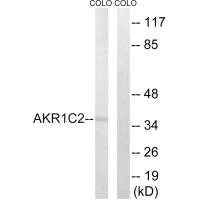 Western blot analysis of extracts from COLO cells, using AKR1C2 antibody.