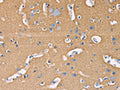 The image on the left is immunohistochemistry of paraffin-embedded Human brain tissue using CSB-PA897922(GNB1 Antibody) at dilution 1/20, on the right is treated with fusion protein. (Original magnification: ×200)