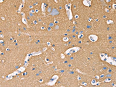 The image on the left is immunohistochemistry of paraffin-embedded Human brain tissue using CSB-PA897922(GNB1 Antibody) at dilution 1/20, on the right is treated with fusion protein. (Original magnification: ×200)