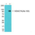 Western blot analysis of extracts from JK cells (Lane 2), using HDAC7A (Ab-155) antiobdy. The lane on the left is treated with synthesized peptide.