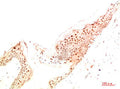Immunohistochemical analysis of paraffin-embedded Human Skin Tissue using ATG14 Rabbit pAb diluted at 1:500