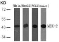 Western blot analysis of extracts from Hela, HepG2, PC12 and HUVEC cells using MEK-2(Ab-394) Antibody.