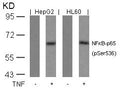 Western blot analysis of extracts from HepG2 and HL60 cells untreated or treated with TNF using NFkB-p65(Phospho-Ser536) Antibody.