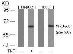 Western blot analysis of extracts from HepG2 and HL60 cells untreated or treated with TNF using NFkB-p65(Phospho-Ser536) Antibody.