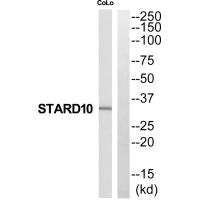 Western blot analysis of extracts from COLO205 cells, using STARD10 antibody.