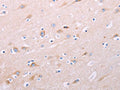 The image on the left is immunohistochemistry of paraffin-embedded Human brain tissue using CSB-PA899170(ADCY5 Antibody) at dilution 1/40, on the right is treated with synthetic peptide. (Original magnification: ×200)