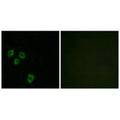 Immunofluorescence analysis of HepG2 cells, using MUC16 antibody.