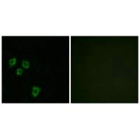 Immunofluorescence analysis of HepG2 cells, using MUC16 antibody.