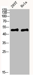 Western blot analysis of mouse-kidney mouse-brain mouse-lung mouse-heart 293T lysate, antibody was diluted at 1000. Secondary antibody  was diluted at 1:20000