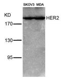 Western blot analysis of extracts from SKOV3 and MDA cells using HER2(Ab-1221/1222) Antibody.