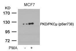 Western blot analysis of extracts from MCF cells untreated or treated with PMA using PKD/PKCm(Phospho-Ser738) Antibody.