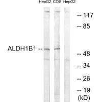 Western blot analysis of extracts from HepG2 cells and COS cells, using ALDH1B1 antibody.