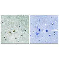 Immunohistochemistry analysis of paraffin-embedded human brain tissue using PAK1 (Ab-204) antibody.