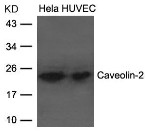 Western blot analysis of extracts from Hela and HUVEC cells using Caveolin-2 Antibody.