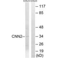 Western blot analysis of extracts from HUVEC cells, using CNN2 antibody.