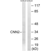 Western blot analysis of extracts from HUVEC cells, using CNN2 antibody.