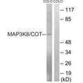 Western blot analysis of extracts from COLO cells, treated with Insulin (0.01U/ml, 15mins), using MAP3K8 (Ab-400) antibody.