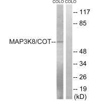 Western blot analysis of extracts from COLO cells, treated with Insulin (0.01U/ml, 15mins), using MAP3K8 (Ab-400) antibody.