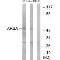 Western blot analysis of extracts from Jurkat cells and COLO cells, using ARSA antibody.
