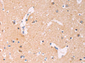 The image on the left is immunohistochemistry of paraffin-embedded Human brain tissue using CSB-PA901817(ADCY1 Antibody) at dilution 1/60, on the right is treated with synthetic peptide. (Original magnification: ×200)