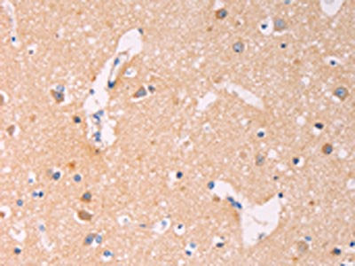 The image on the left is immunohistochemistry of paraffin-embedded Human brain tissue using CSB-PA901817(ADCY1 Antibody) at dilution 1/60, on the right is treated with synthetic peptide. (Original magnification: ×200)