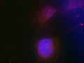 Immunofluorescence staining of methanol-fixed Hela cells using BRCA1(Phospho-Ser988) Antibody.
