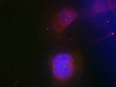 Immunofluorescence staining of methanol-fixed Hela cells using BRCA1(Phospho-Ser988) Antibody.