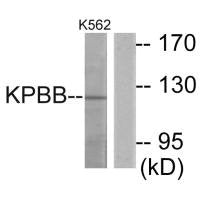 Western blot analysis of extracts from K562 cells, using KPBB antibody.
