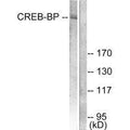 Western blot analysis of extracts from HeLa cells, treated with insulin (0.01U/ml, 15mins), using CREB-BP antibody.
