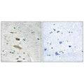Immunohistochemistry analysis of paraffin-embedded human brain tissue using ABHD4 antibody.