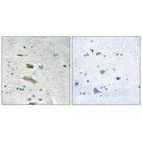 Immunohistochemistry analysis of paraffin-embedded human brain tissue using ABHD4 antibody.