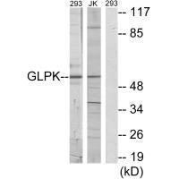 Western blot analysis of extracts from 293 cells and Jurkat cells, using GLPK antibody.