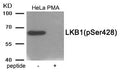 Western blot analysis of extracts from HeLa cells treated with PMA using Phospho-LKB1 (Ser428) antibody.The lane on the right is treated with the antigen-specific peptide.