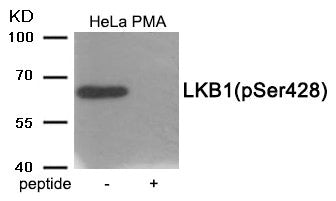 Western blot analysis of extracts from HeLa cells treated with PMA using Phospho-LKB1 (Ser428) antibody.The lane on the right is treated with the antigen-specific peptide.