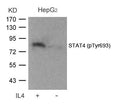 Western blot analysis of extracts from HepG2 cells untreated or treated with IL-4 using STAT4(Phospho-Tyr693) Antibody.