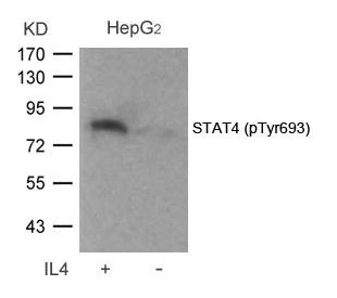 Western blot analysis of extracts from HepG2 cells untreated or treated with IL-4 using STAT4(Phospho-Tyr693) Antibody.