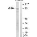 Western blot analysis of extracts from RAW264.7 cells, treated with UV (5mins), using MSK2 (Ab-568) antibody.