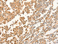The image on the left is immunohistochemistry of paraffin-embedded Human tonsil tissue using CSB-PA903058(NAP1L1 Antibody) at dilution 1/70, on the right is treated with fusion protein. (Original magnification: ×200)