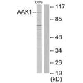 Western blot analysis of extracts from COS7 cells, using AAK1 antibody.